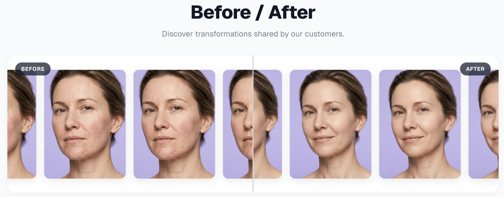 Preview — Before / After carousel